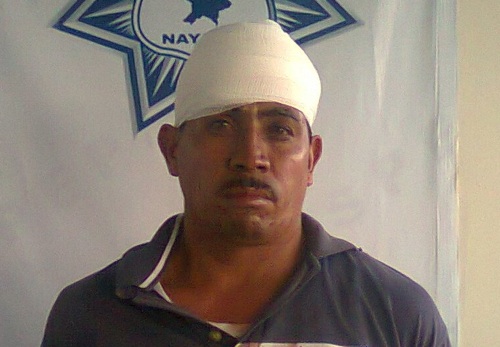 Delincuentes Balean a su Víctima; Capturan a Uno