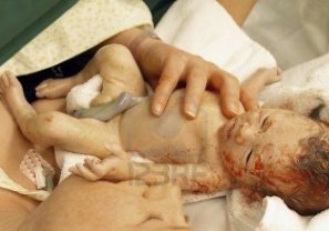 Pasantes Médicos de San José Incapaces de Cortar Cordón Umbilical