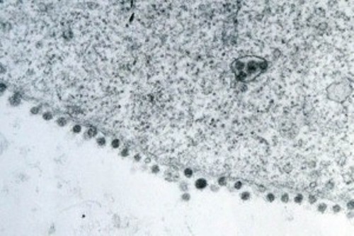 Mueren Dos Personas Más Por Nuevo Coronavirus
