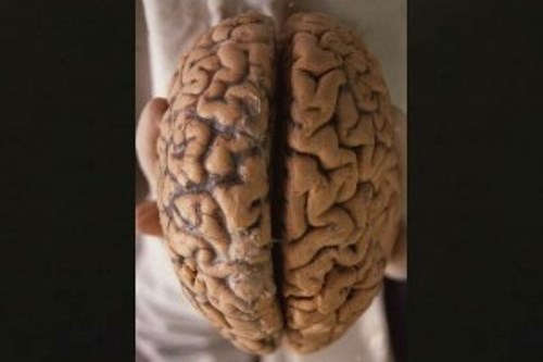 La pobreza moldea el cerebro: estudio