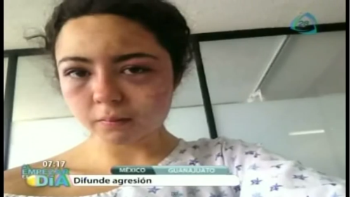 Joven es golpeada por negarse a tener sexo con un conocido