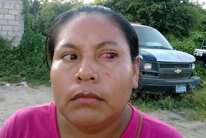 Supervisora dio tremendo puñetazo a madre de familia