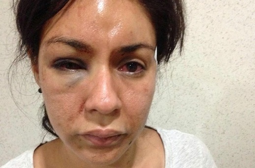 Sujeto Atacó Brutalmente a una Joven; Lo Detuvieron pero Fiscalía lo Dejó Libre